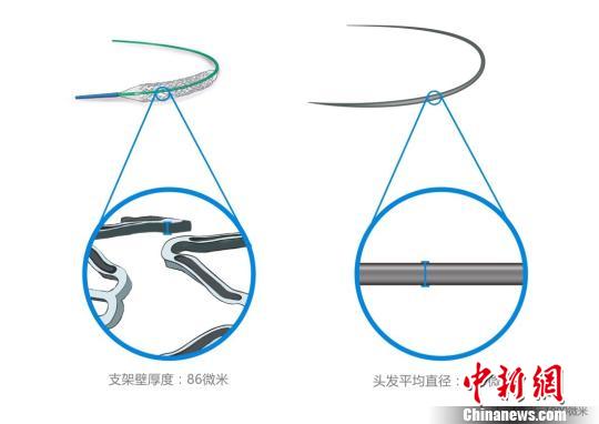 火鷹支架壁的凹槽與頭發(fā)直徑對(duì)比圖?！」﹫D 攝