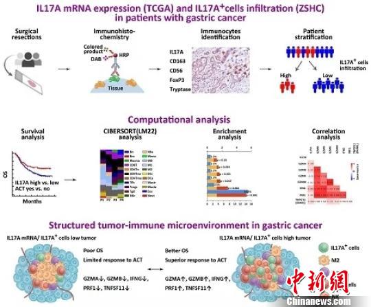 中國科學(xué)家發(fā)現(xiàn)胃癌微環(huán)境抗腫瘤免疫機(jī)制